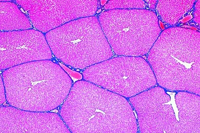 Mikropräparat - Leber vom Schwein, quer. Interlobuläres Bindegewebe