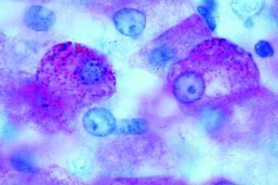 Mikropräparat - Leber, Glykogenfärbung, quer