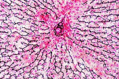 Mikropräparat - Leber, Imprägnation der Gallengänge, quer *
