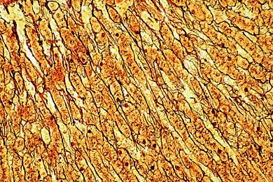 Mikropräparat - Leber, Silberimprägnation des retikulären Bindegewebes, quer
