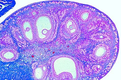 Mikropräparat - Eierstock (Ovarium) der Katze, quer