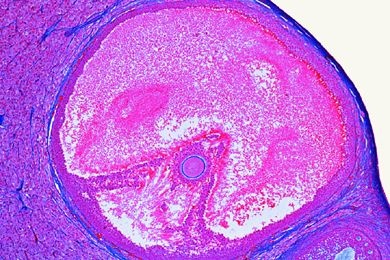 Mikropräparat - Eierstock der Katze, quer, Sprungreifer Graafscher Follikel mit abgelöster Eizelle