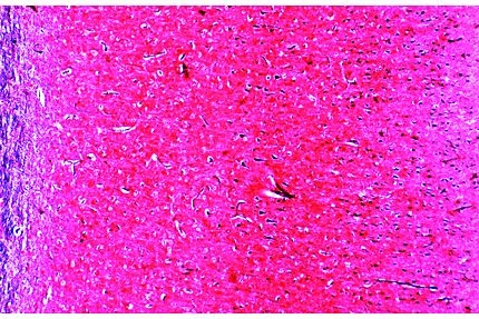 Mikropräparat - Großhirnrinde der Katze, quer, Übersichtspräparat