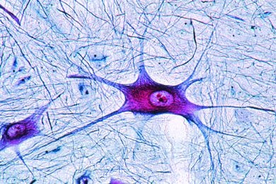 Mikropräparat - Rückenmark der Katze, quer, Klüver-Barrera