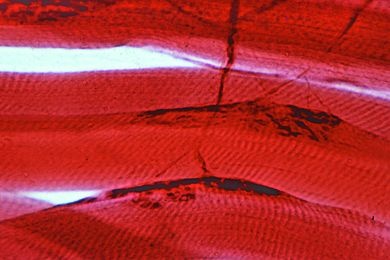 Mikropräparat - Motorische Nervenendungen im Muskel, Goldchloridmethode...