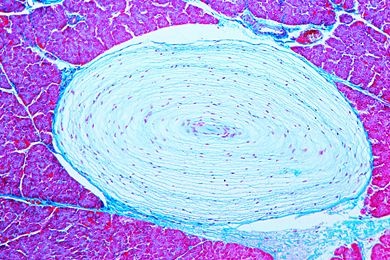 Mikropräparat - Pacinische Körperchen in Mesenterium oder Pankreas