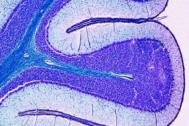 Mikropräparat - Kleinhirn, quer, Markscheidenfärbung *