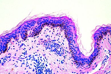 Mikropräparat - Körperhaut vom Menschen (Neger), quer (vertikal)