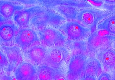 Mikropräparat - Haut von der Handfläche des Menschen, Flachschnitt (horizontal)