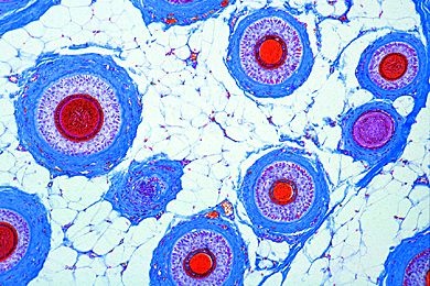 Mikropräparat - Kopfhaut des Menschen, Flachschnitt (horizontal)