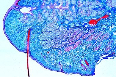 Mikropräparat - Augenlid der Katze mit Meibomscher Drüse, quer (vertikal)