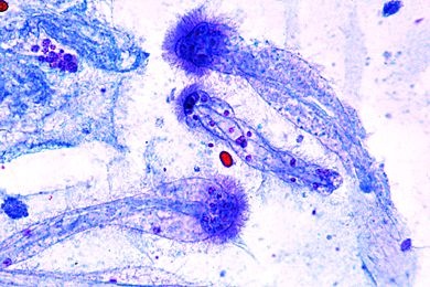 Mikropräparat - Dicyema, einfachster Vielzeller bestehend aus Körper- und Fortpflanzungszellen