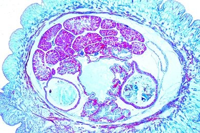 Mikropräparat - Schnecke, junges Tier, Körpermitte quer