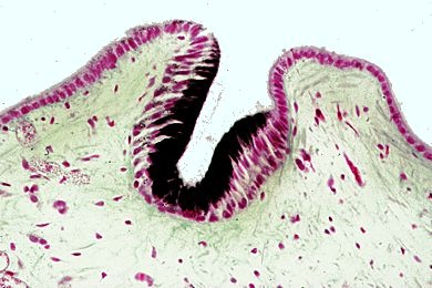 Mikropräparat - Patella spec., Napfschnecke, einfaches Grubenauge, längs