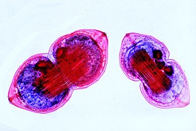 Mikropräparat - Anodonta, Teichmuschel, Glochidien (Larven) total