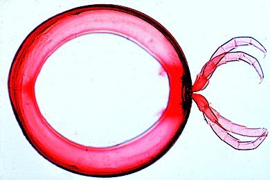 Mikropräparat - Julus, Diplosegment mit zwei Beinpaaren, total