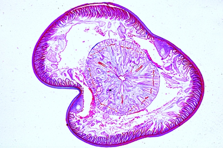 Mikropräparat - Ascaris lumbricoides, Schlundregion mit Oesophagus, quer