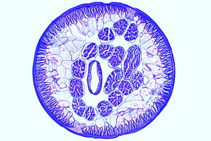 Mikropräparat - Ascaris lumbricoides, Männchen, Geschlechtsregion quer