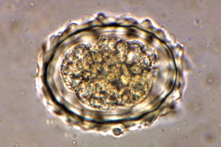 Mikropräparat - Ascaris lumbricoides, Eier im Stuhl
