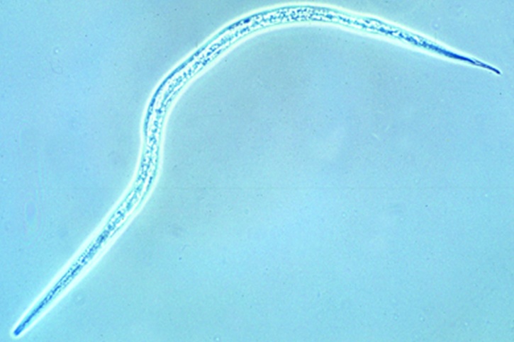 Mikropräparat - byloides, filariforme (infektiöse) Larven, total
