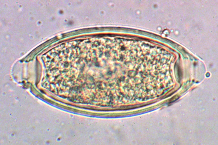 Mikropräparat - Trichuris trichiura, Eier im Stuhl
