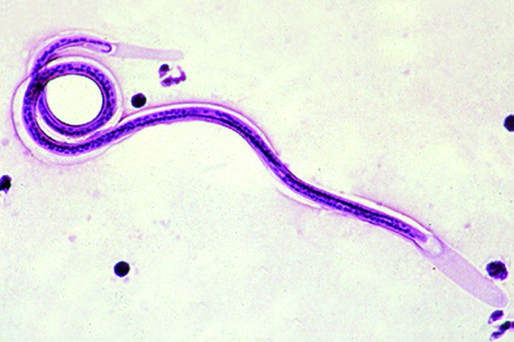 Mikropräparat - Microfilaria, im Ausstrich von der Lunge eines Vogels*