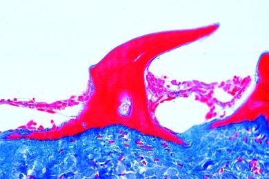 Mikropräparat - Scyllium, Haut mit Placoidschuppen, quer