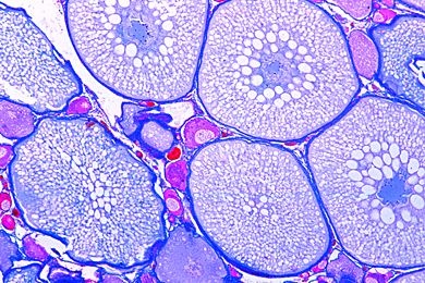Mikropräparat - Cyprinus, Ovarium quer