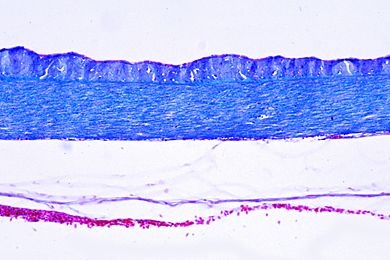 Mikropräparat - Cyprinus, Schwimmblase quer