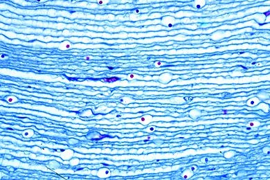 Mikropräparat - Torpedo marmorata, Zitterrochen, elektrisches Organ, quer