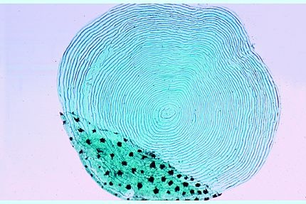 Mikropräparat - Cycloidschuppen