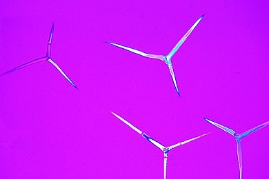 Mikropräparat - Sycon, isolierte Kalknadeln