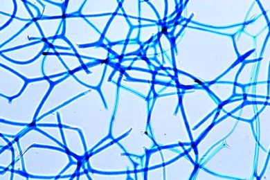 Mikropräparat - Euspongia, Badeschwamm, mazeriertes Spongiolinskelett