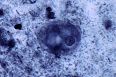 Mikropräparat - Entamoeba coli, Ausstrich mit vegetativen Formen (Trophozoiten), Spezialfärbung *