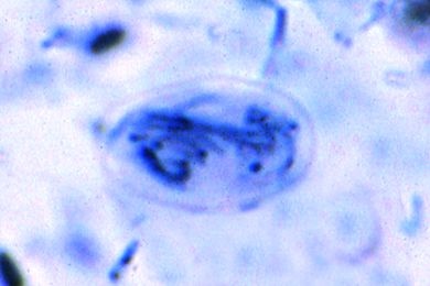 Mikropräparat - Giardia lamblia intestinalis, Ausstrich mit Zysten *