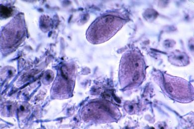 Mikropräparat - Trichomonas spec., Ausstrich