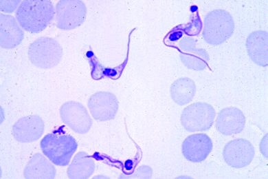 Mikropräparat - Trypanosoma cruzi (Schizotrypanum), Erreger der Chagaskrankheit des Menschen. Blutausstrich mit Trypanosomen