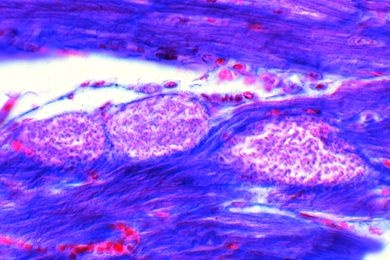 Mikropräparat - Trypanosoma cruzi, Leishmania-Formen, Herzmuskel Maus quer