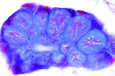 Mikropräparat - Plasmodium spec., Speicheldrüsen einer infizierten Anopheles... *
