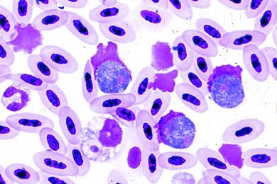 Mikropräparat - Leukocytozoon, Blutausstrich vom Huhn mit Parasiten *