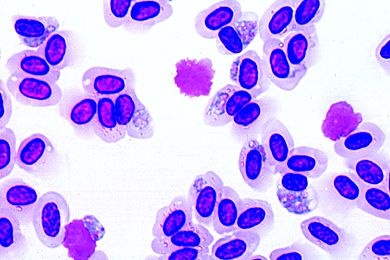 Mikropräparat - Plasmodium cathemerium, Vogelmalaria, Blutausstrich *