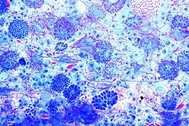 Mikropräparat - Monocystis lumbrici, Ausstrich aus den Samenblasen des Regenwurms