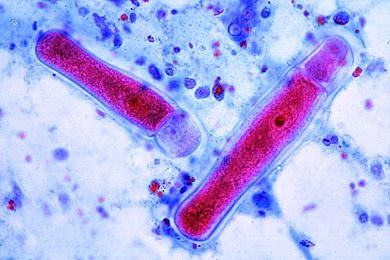 Mikropräparat - Gregarina, Ausstrich aus dem Darm des Mehlwurms (Tenebrio)