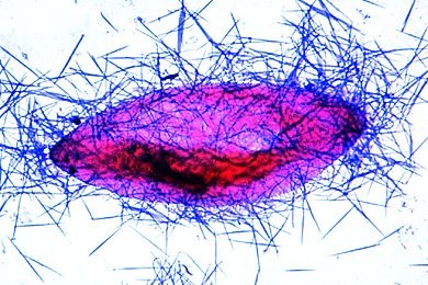 Mikropräparat - Paramaecium, Trichocysten (Karbolfuchsin)