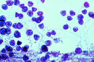 Mikropräparat - Vorticella, marine Formen