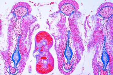 Mikropräparat - Trichodina domergueri, Parasit an Fischkiemen. Schnitt *