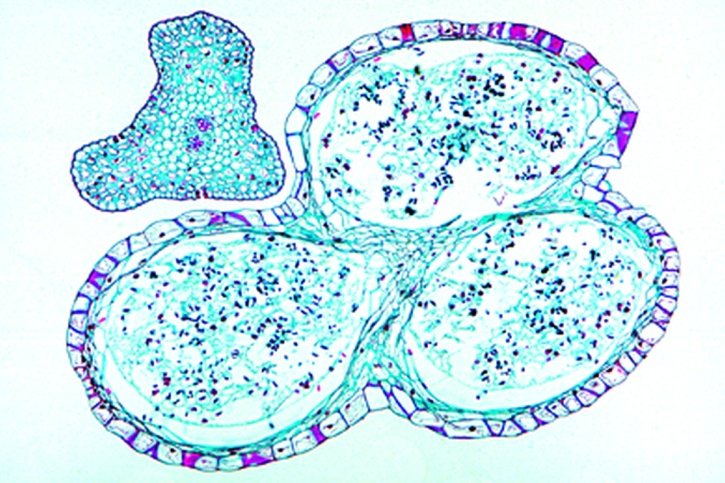 Mikropräparat - Psilotum, dreifächeriges Sporangium mit Isosporen, quer *
