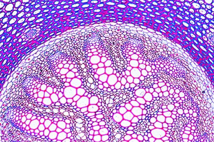 Mikropräparat - Lycopodium, Rhizom, quer