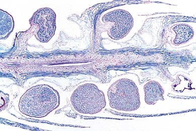 Mikropräparat - Lycopodium, Sporophyllstand, quer. Isosporen