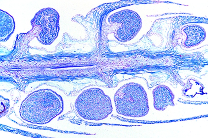 Mikropräparat - Lycopodium, junger Sporophyllstand, längs